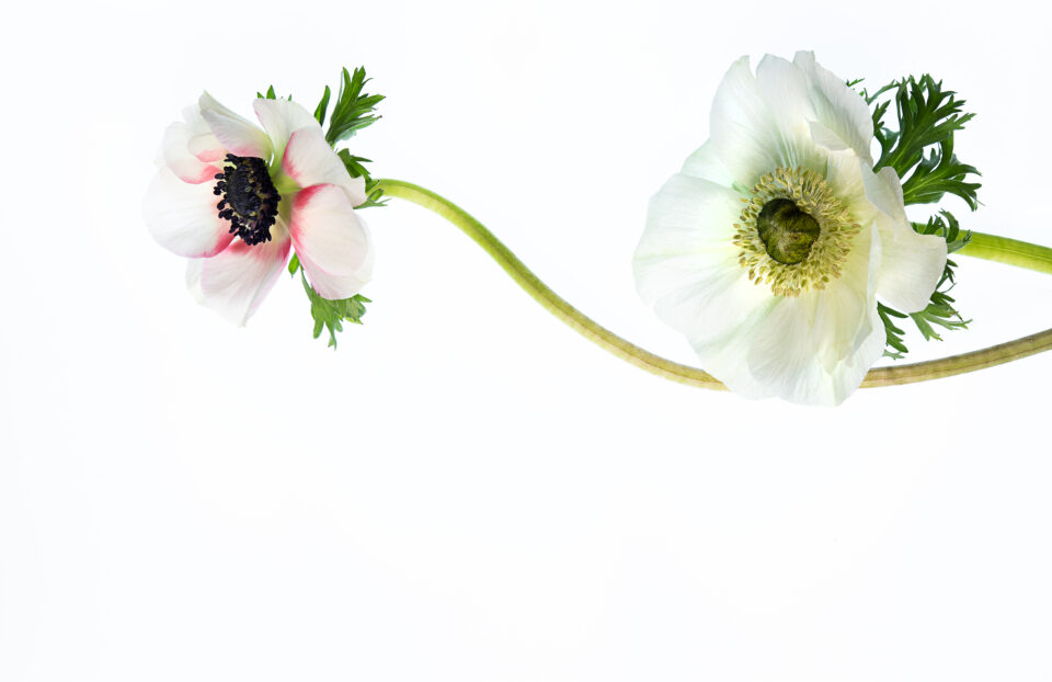 Labiaplasty Scars: Your Most Common Questions Answered